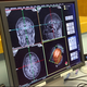 Illustration for article titled This Is Your Brain On Video Games